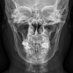 mandible PA.Seq1.Ser1.Img1