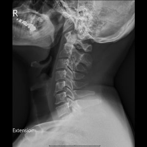 C EXT.Seq1.Ser1.Img1