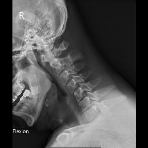 C FLE.Seq2.Ser1.Img1