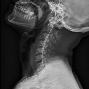 C LAT.Seq2.Ser1.Img1