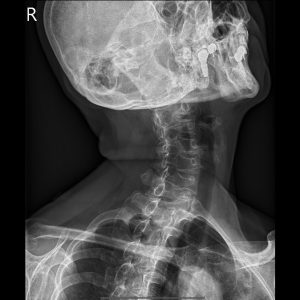 C RPO.Seq1.Ser1.Img1