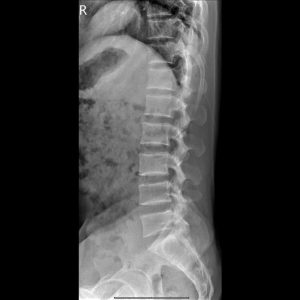 L LAT.Seq2.Ser1.Img1