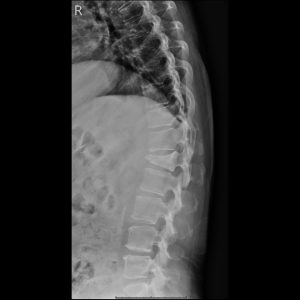 TL LAT.Seq1.Ser1.Img1