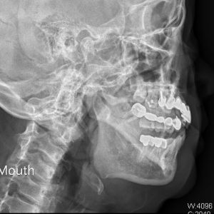 open mouth b75148.Seq1.Ser1.Img1