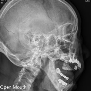 open mouth b75418.Seq2.Ser1.Img1