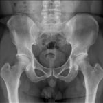 pelvis.Seq1.Ser1.Img1