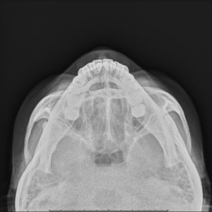 zygomaarch 663858.Seq1.Ser1.Img1