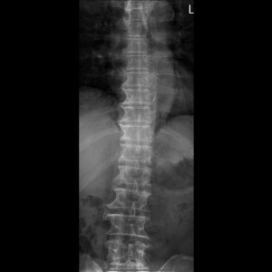 匿名.Seq1.Ser1.Img1