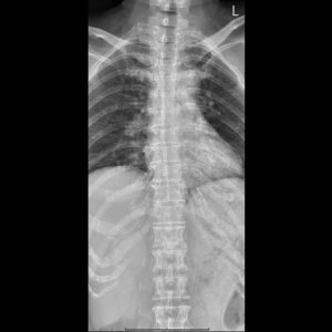 匿名.Seq1.Ser1.Img1