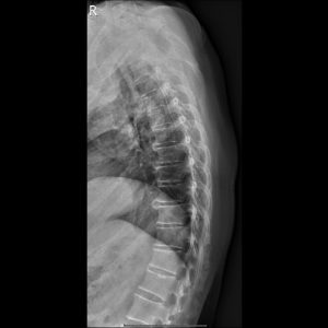 匿名.Seq2.Ser1.Img1